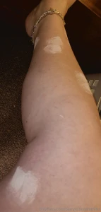 So i might be mia for the week i m covered in poison ivy so that means part 3