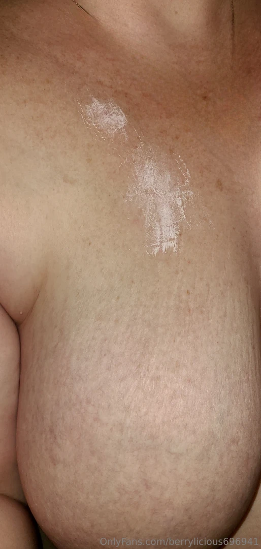 So i might be mia for the week i m covered in poison ivy so that means 