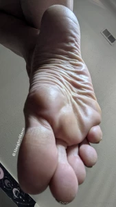 Open wide for this huge sole look at those calluses you can help