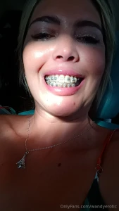 At the orthodontist s office