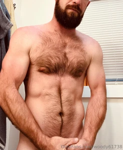 Welcome to summer the burn has started i need lotion send tips