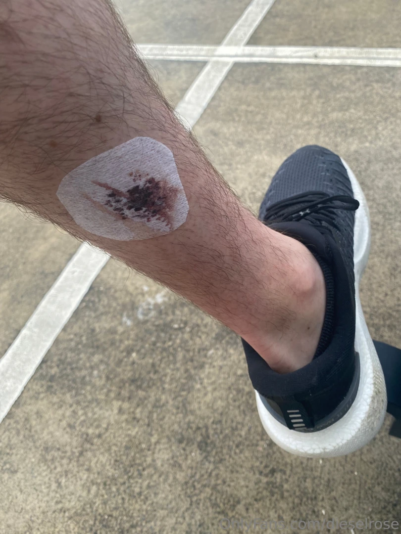 Sorry i ve been quiet for a while doctors have had fun carving a few 