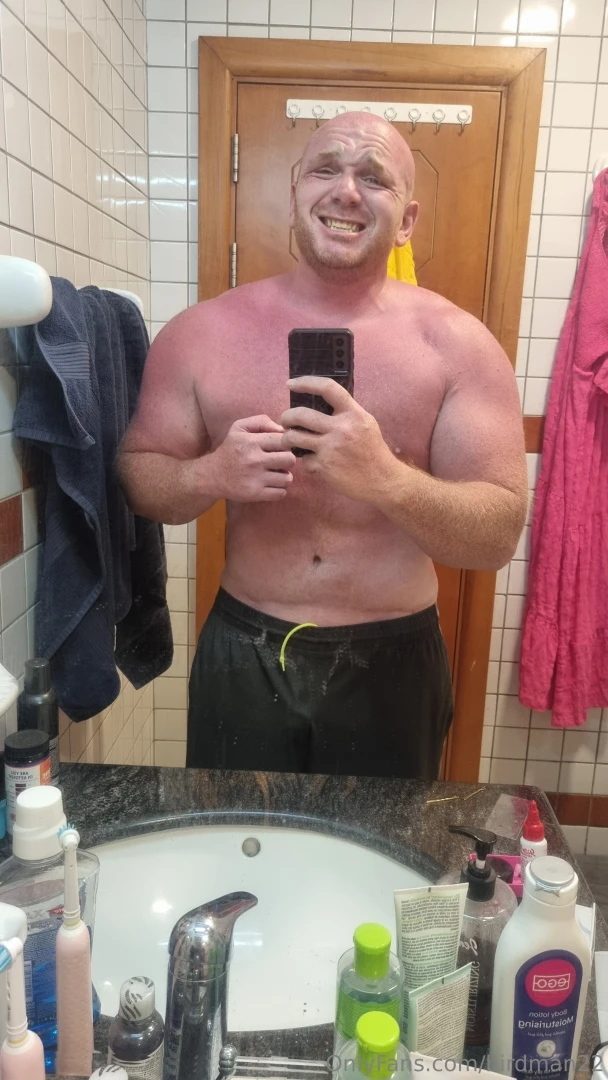 Got a little burned today 