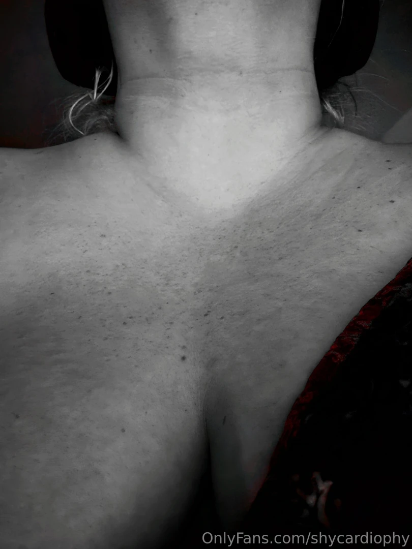 Beautiful chest sun damage freckles and all just waiting to be 