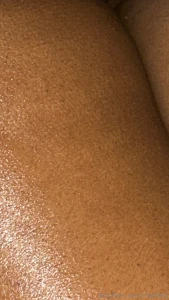 It s skin week and today is mlk day thank you dr king for teaching us part 2