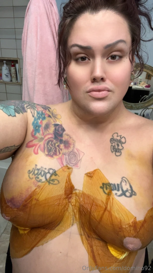 Healing nicely part 1 