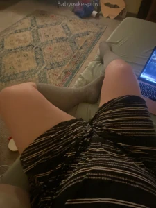 Currently in surgery wish me luck lt 3 part 1