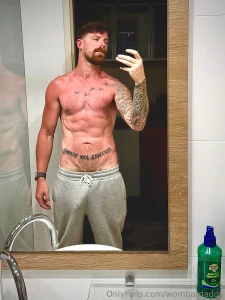 Who wants to rub some aloe vera on my burn