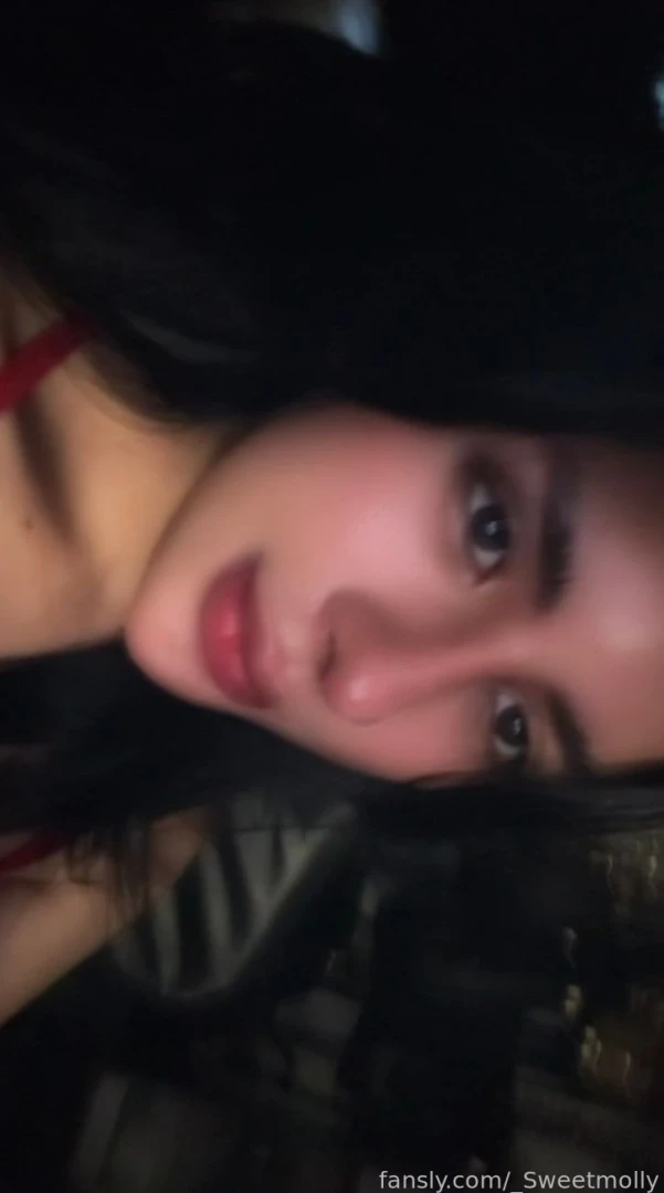 10th days post op from rhinoplasty getting better 