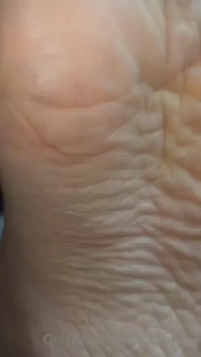 How many wrinkles you see 