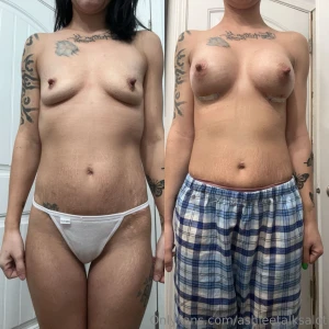 Some before and afters of the booobies as always tips are appreciated