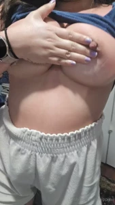 Sunburnt part 3