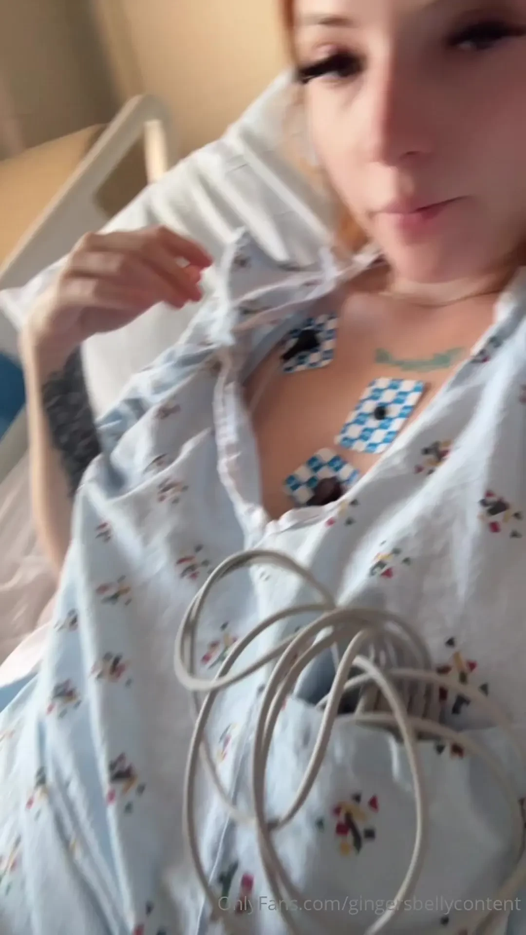 I ve been in the hospital 4 days now i have kidney disease 
