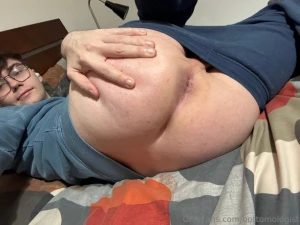 People wanted an update on my hole after laser hair removal part 1