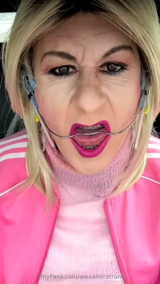 Disclaimer this post is all about braces headgear fetish - and may not part 1 