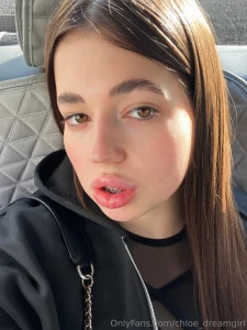 Hello friends today is an important day i got braces yes i m on my way