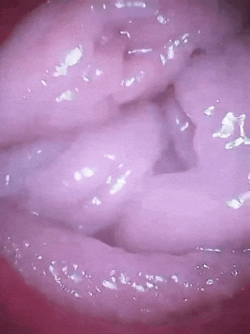 Omg you feel so fucking good inside me endoscopy pussyvore pussy vore 