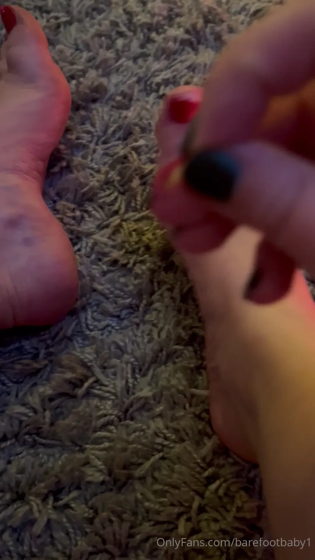 Toenail up for grabs 