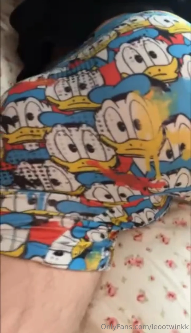 Front or back part 3661 