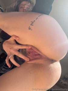 Red and swollen part 1