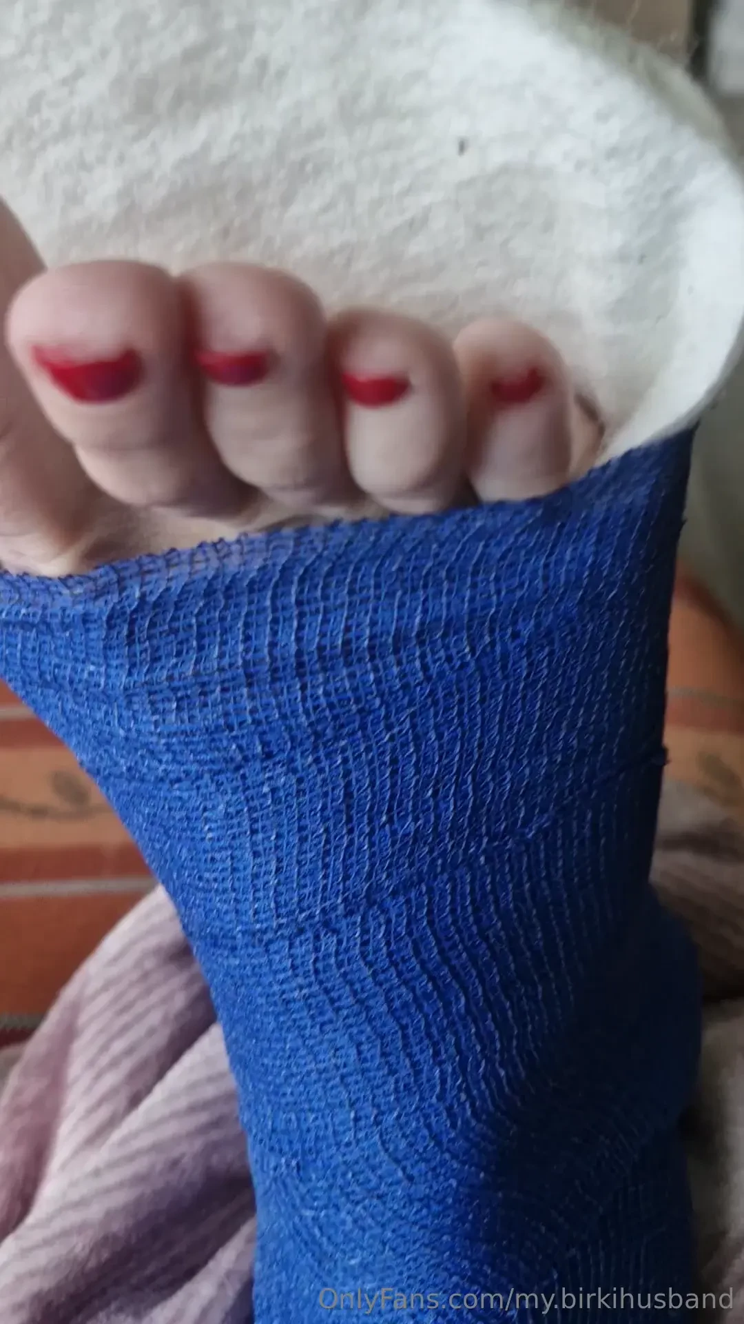 Exclusiv f r meine cast-fans hab mir mal meine gipsschniene mit blauem 
