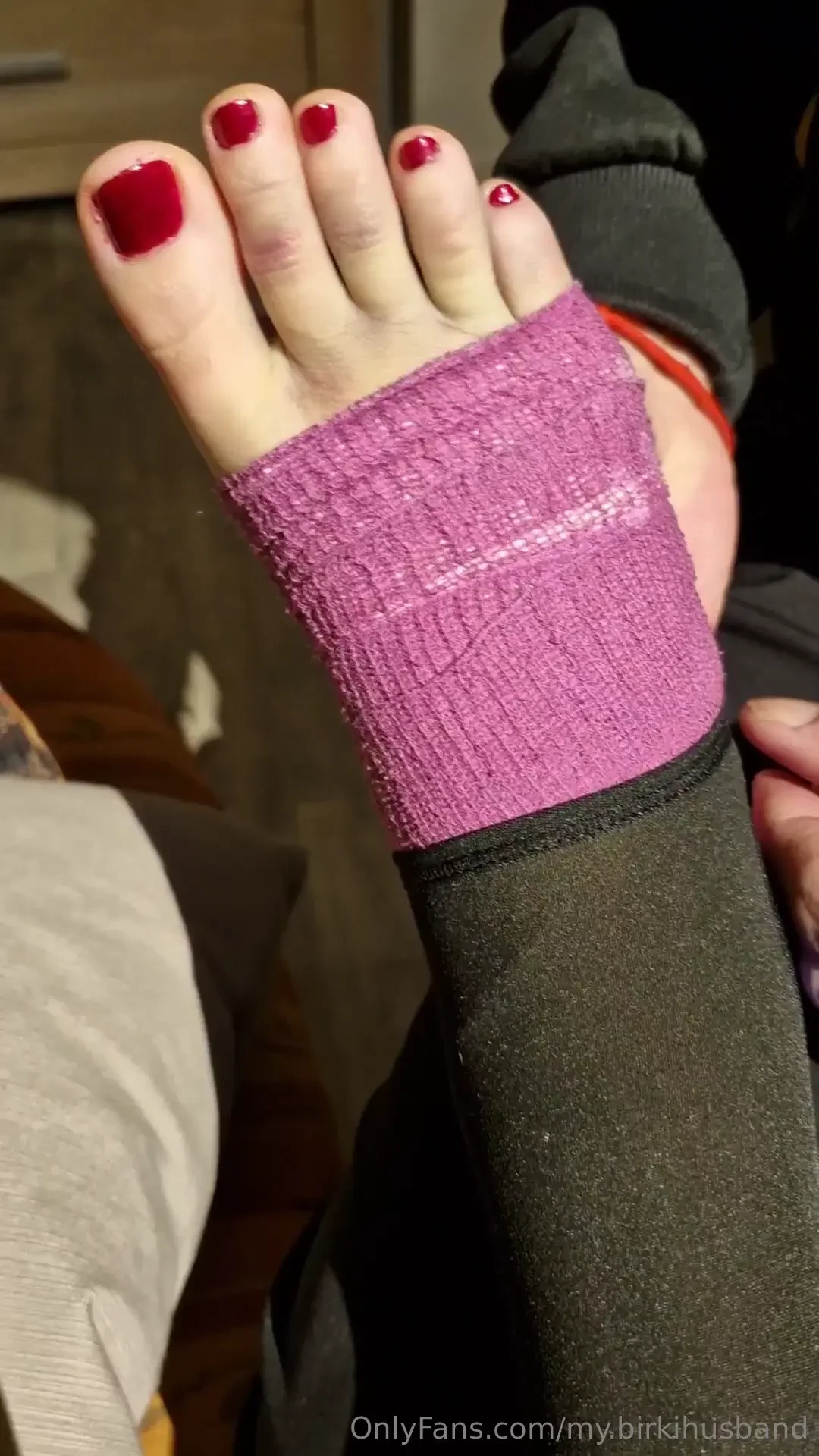 Unboxing fu aus dem zink-lein-verband autsch aber ich wollte ihn mal 