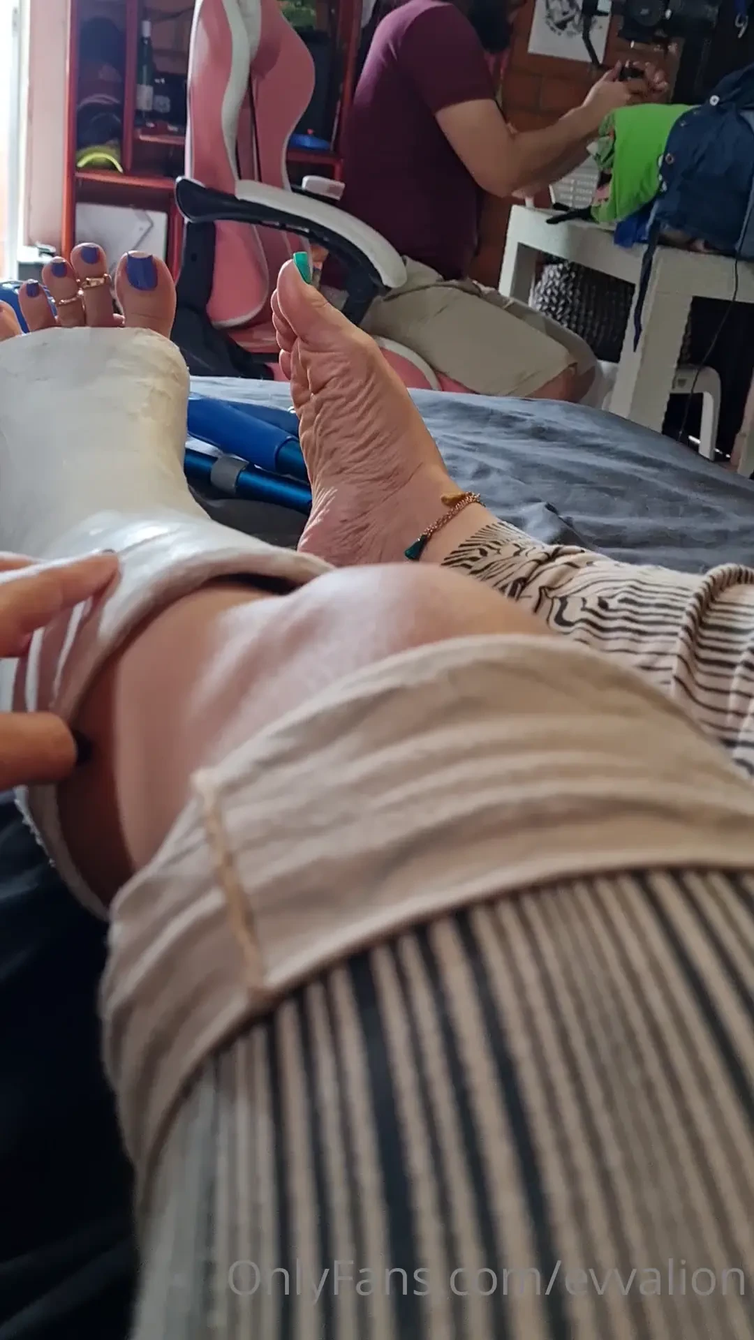 This last weekend my caster put a short leg cast in yelahiag s leg i 