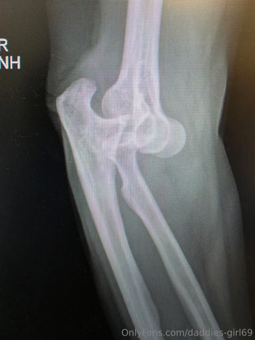 Well my friends it might be a while b4 im posting fun stuff again 