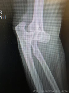 Well my friends it might be a while b4 im posting fun stuff again