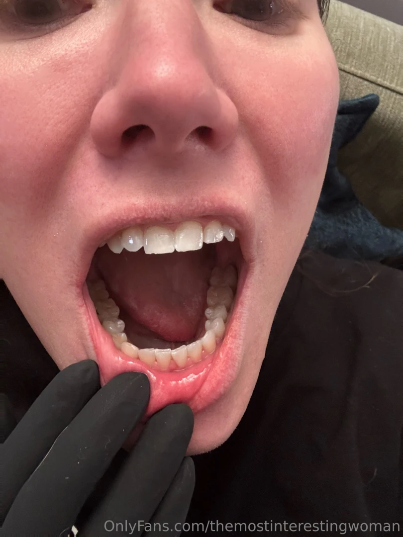 So i know many of you are also into dental fetish content and i m a part 7 