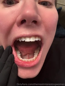 So i know many of you are also into dental fetish content and i m a