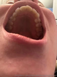 So i know many of you are also into dental fetish content and i m a part 1