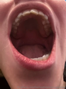 So i know many of you are also into dental fetish content and i m a part 5