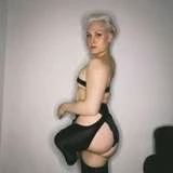 hollyshaleramputee