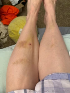 Recovering from a freak accident i was loading up a car to move for a part 3