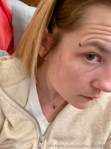 Recovering from a freak accident i was loading up a car to move for a part 4