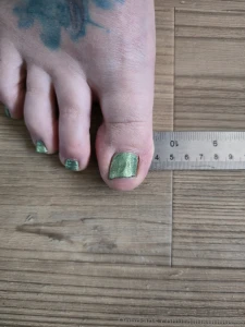 My huge big toe