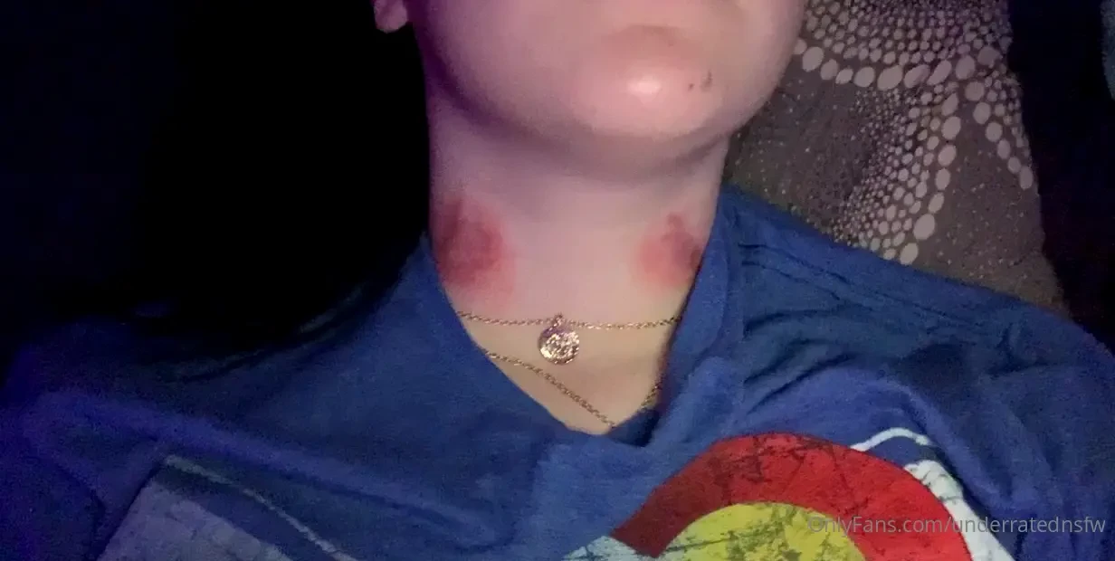 I luv hickeys 