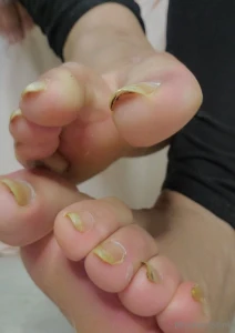 Wanna focus on some gnarly toenails wanna fantasize about sucking on