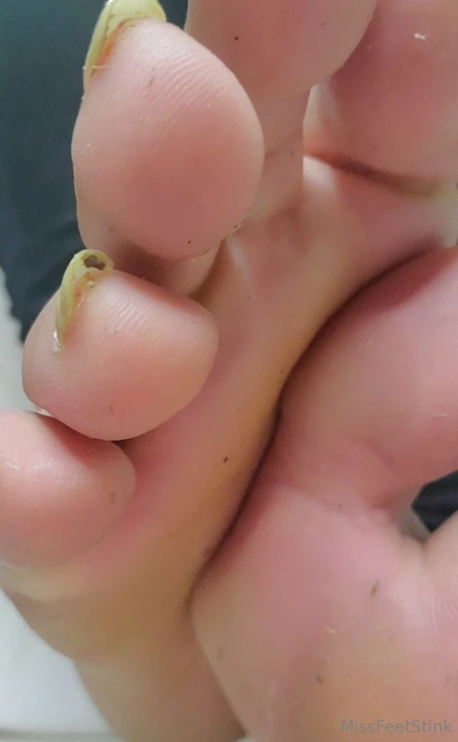 Wanna focus on some gnarly toenails wanna fantasize about sucking on part 2 