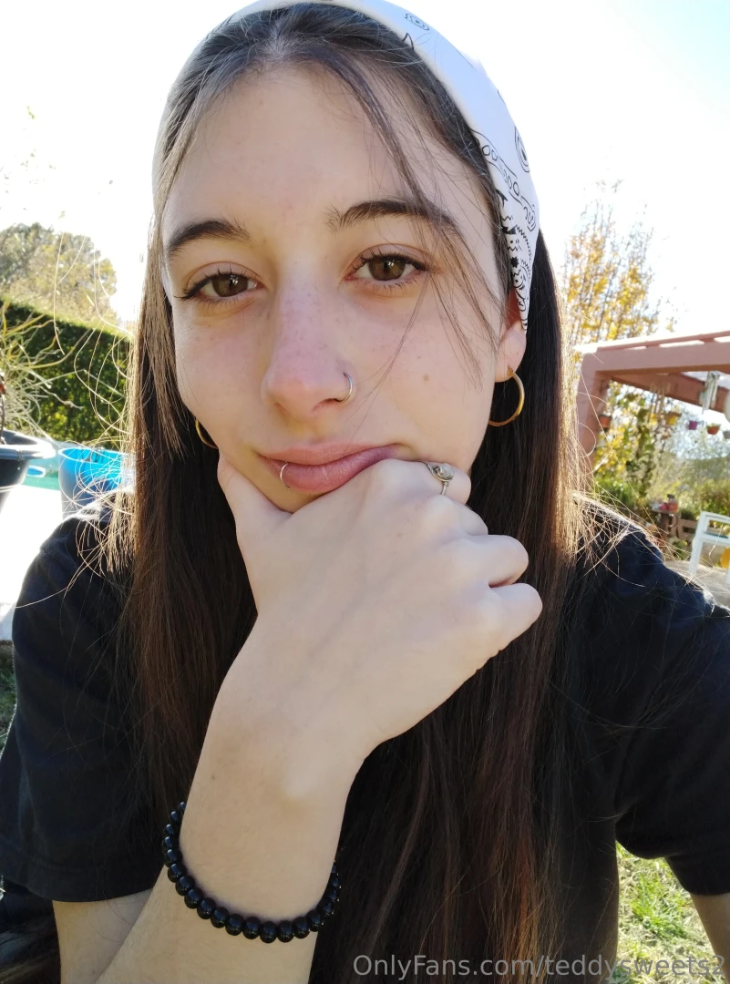 Freckles part 9 