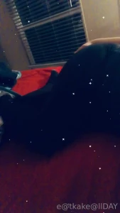 I had really serious surgery almost 9 mo ago i m always real and show