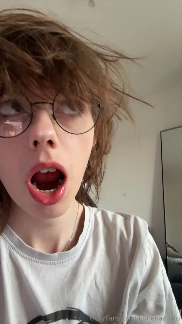 Need transgender surgeries 