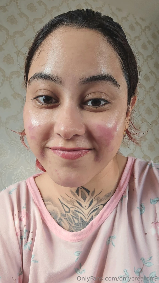 Chemical peel adverse reaction not something to mess with 