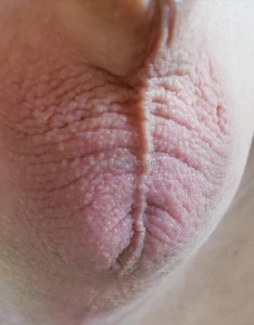 My balls are so tiny and sensitive