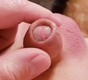 Notkylewerner part 2