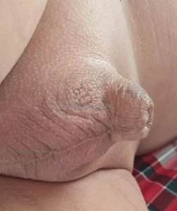 My forever virgin nub and basically non existent balls