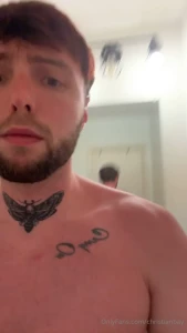 Got a little burnt at the beach anyone have some aloe