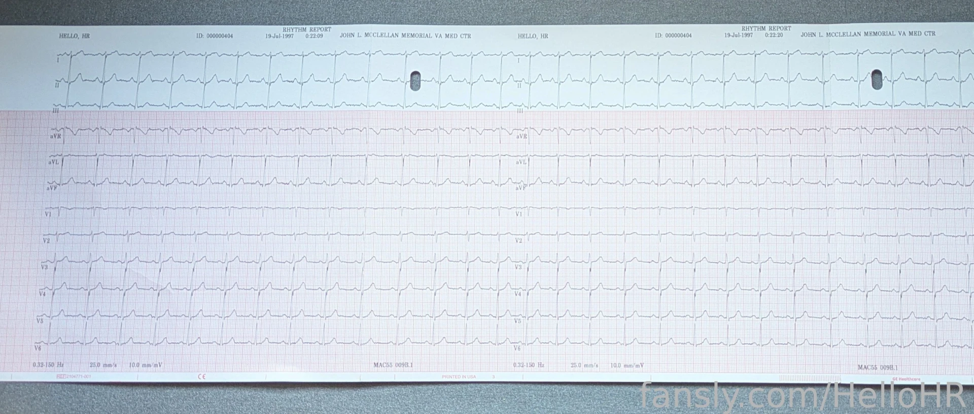 Wearing a gas mask while wired up to the ecg my heart was around 69 part 2 