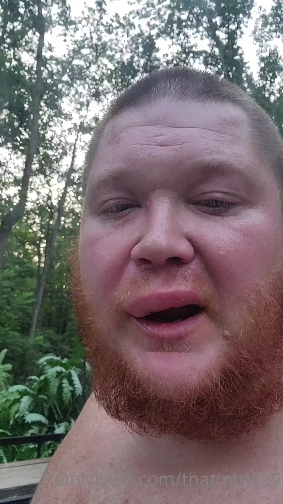 Got attacked ny yellow jackets while doing some tractor work 